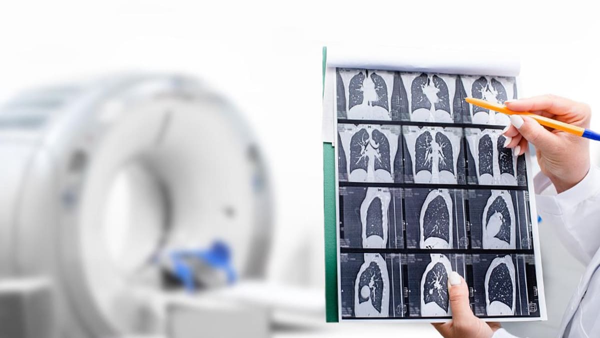 What Should I Expect During a Lung Scan? post